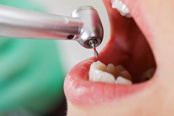 Best Emergency Cosmetic Dentistry (e.g., broken veneers) in Blanchard, OK